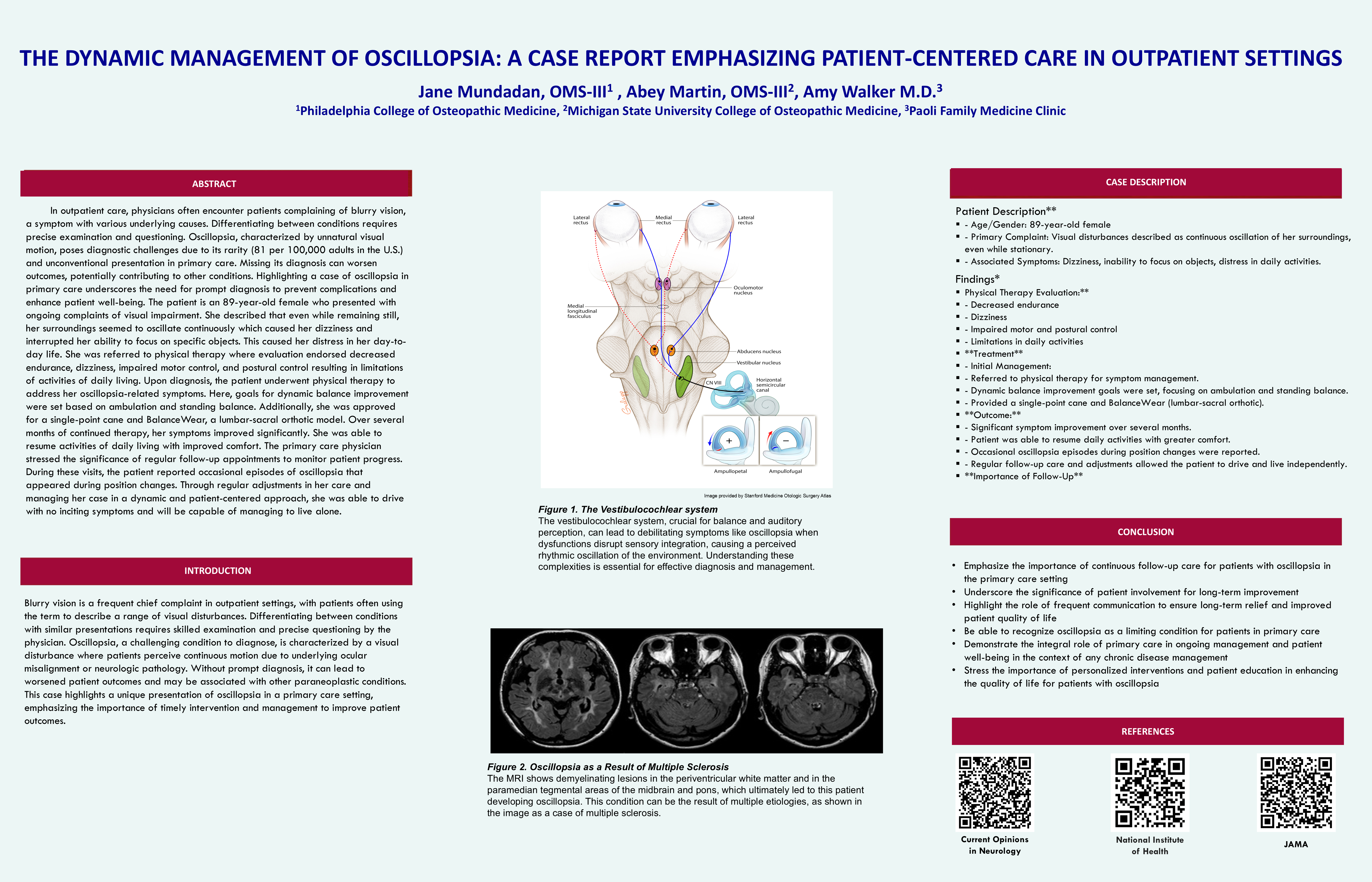 The Dynamic Management Of Oscillopsia